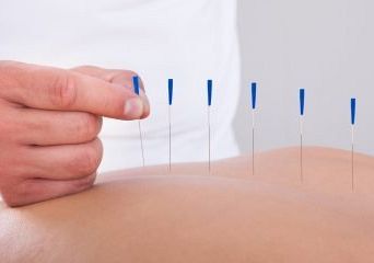 Maak kennis met acupunctuur, de eerste behandeling is gratis